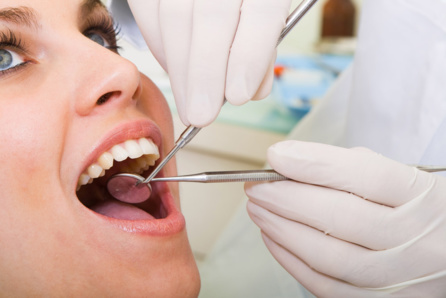 Pose d'implant dentaire