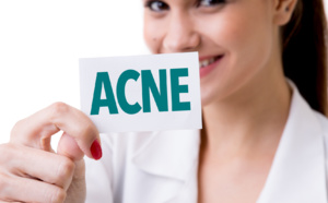 remèdes naturels contre l'acné